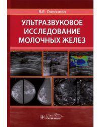 Ультразвуковое исследование молочных желез. Руководство