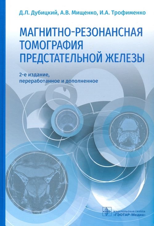 Магнитно-резонансная томография предстательной железы