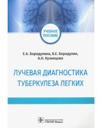 Лучевая диагностика туберкулеза легких. Учебное пособие