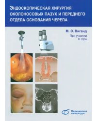 Эндоскопическая хирургия околоносовых пазух и переднего отдела основания черепа