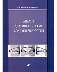 Анализ диагностических моделей челюстей