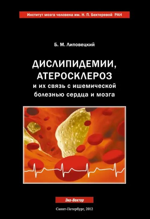 Дислипидемии, атеросклероз и их связь с ишемической болезнью сердца и мозга. Руководство для врачей