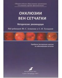 Окклюзии вен сетчатки