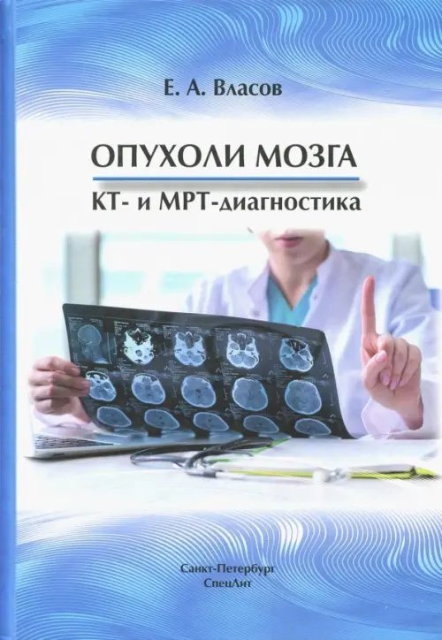 Опухоли мозга КТ- и МРТ- диагностика