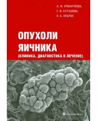 Опухоли яичника (клиника, диагностика и лечение)