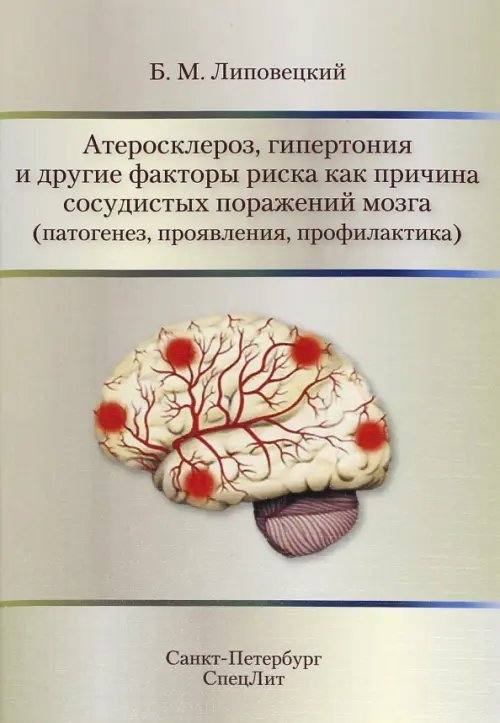 Атеросклероз, гипертония и другие факторы риска как причина сосудистых поражений мозга