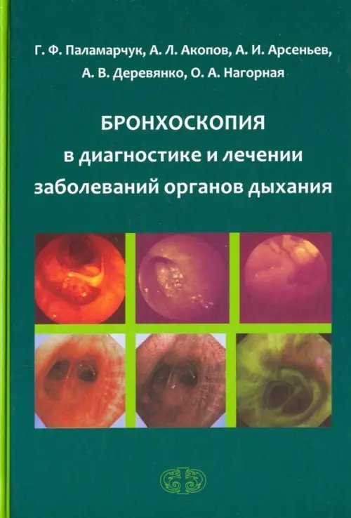 Бронхоскопия в диагностике и лечении заболеваний органов дыхания