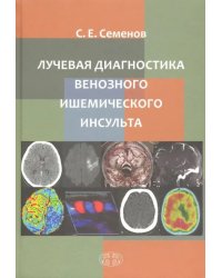 Лучевая диагностика венозного ишемического инсульта