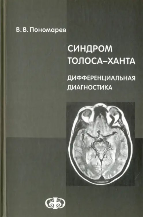 Синдром Толоса-Ханта. Дифференциальная диагностика (случаи из практики). Руководство для врачей