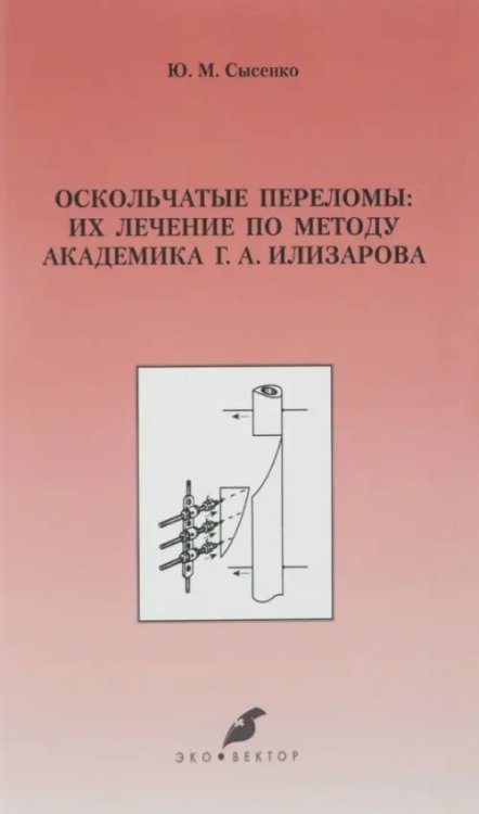 Оскольчатые переломы. Их лечение по методу академика Г. А. Илизарова. Монография