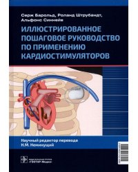 Иллюстрированное пошаговое руководство по применению кардиостимуляторов