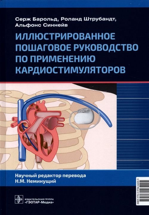 Иллюстрированное пошаговое руководство по применению кардиостимуляторов