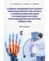 Судебно-медицинская оценка повреждений костей скелета с применением методов лучевой диагностики