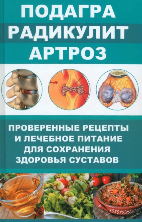 Подагра. Радикулит. Артроз. Проверенные рецепты и лечебное питание для сохранения здоровья суставов