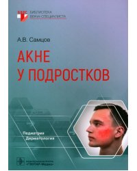 Акне у подростков. Руководство