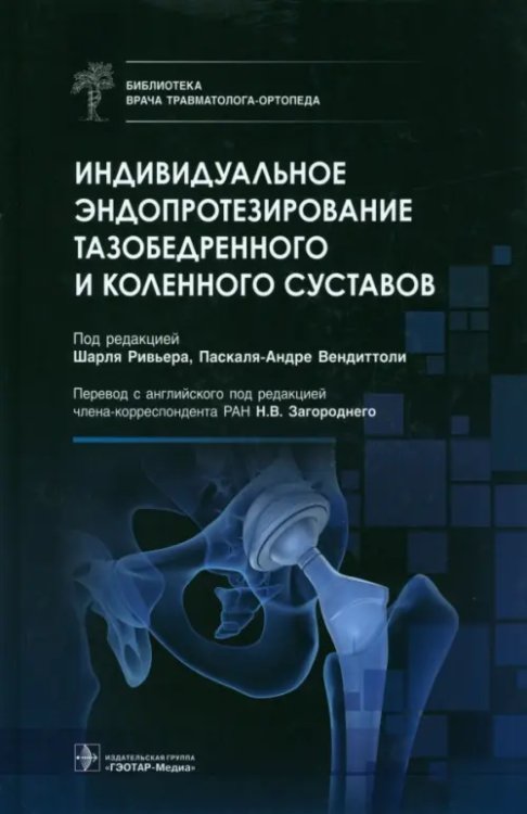 Индивидуальное эндопротезирование тазобедренного и коленного суставов