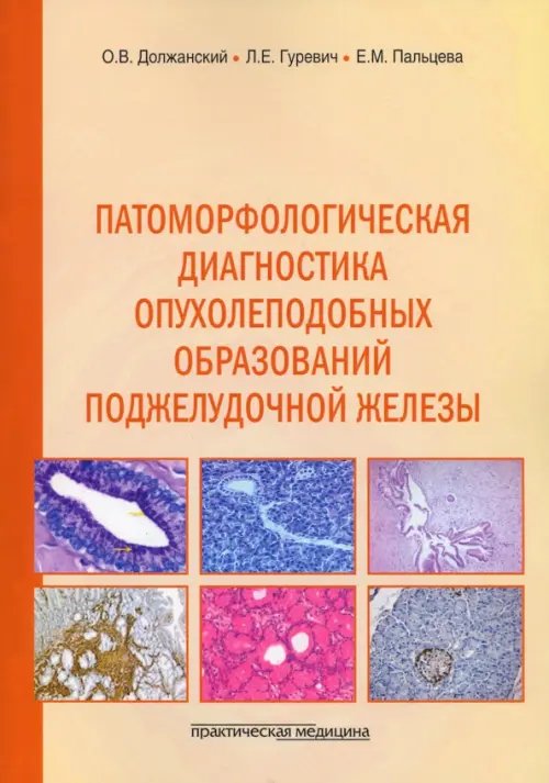 Патоморфологическая диагностика опухолеподобных образований поджелудочной железы. Руководство