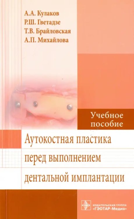 Аутокостная пластика перед выполнением дентальной имплантации