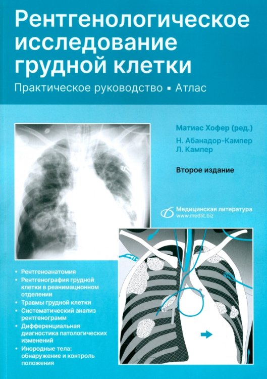 Рентгенологическое исследование грудной клетки. Практическое руководство. Атлас