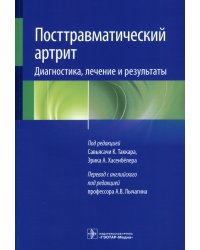 Посттравматический артрит. Диагностика, лечение и результаты