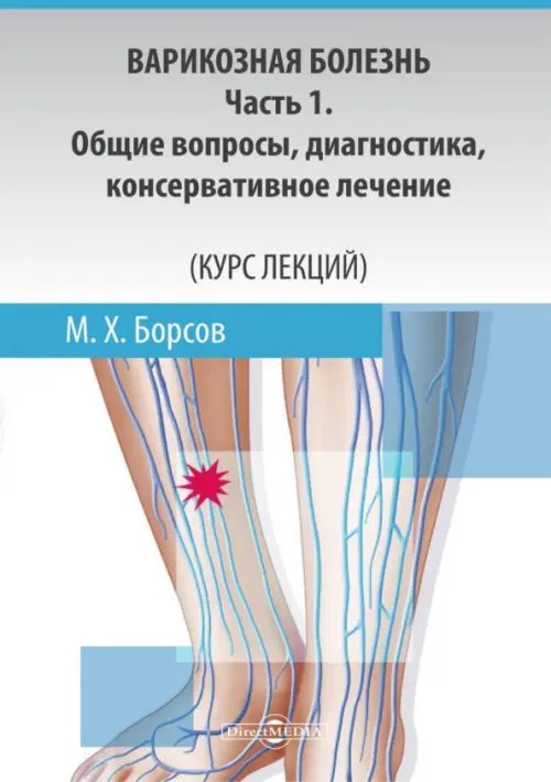 Варикозная болезнь. Часть 1. Общие вопросы, диагностика, консервативное лечение. Курс лекций