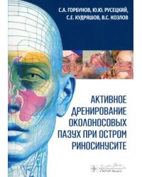 Активное дренирование околоносовых пазух при остром риносинусите